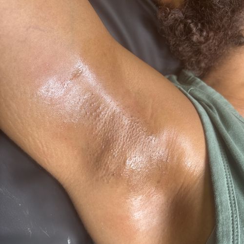Smooth, clean underarm straight after an underarm wax at Soleil Beauty Bar