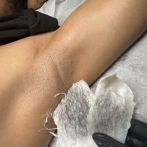 Hair lifted away on the strip during an underarm wax at the Hartford studio