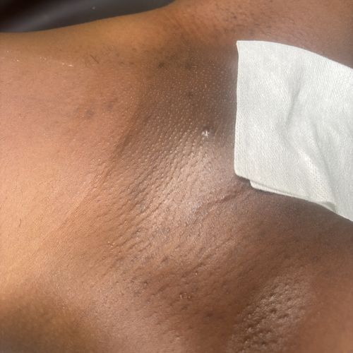 Freshly waxed underarm, hair removed in a single clean pass